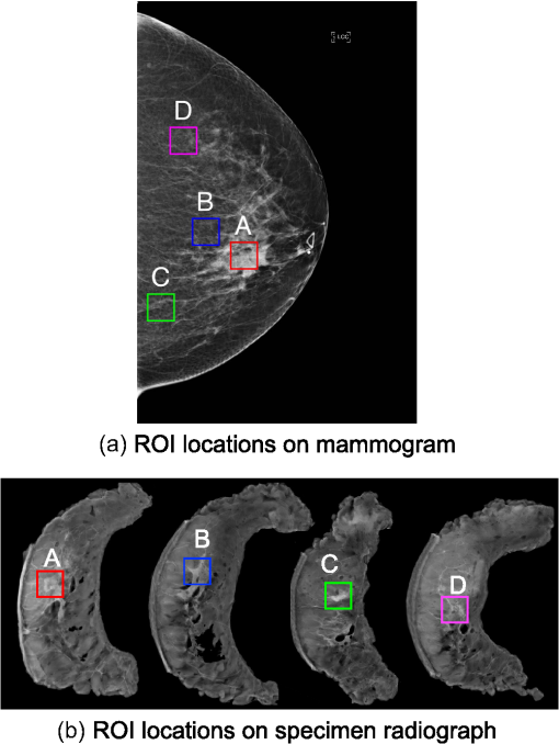 JMI_10_4_044501_f001.png